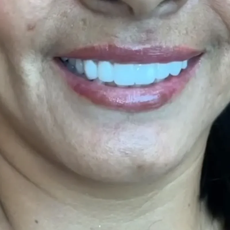 Detalle de la nueva sonrisa de Magaly