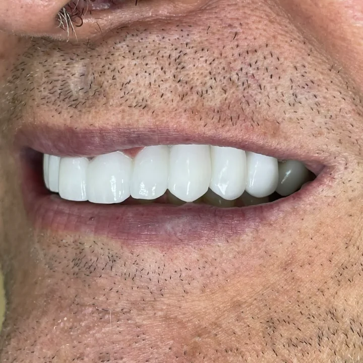 Resultado de perfil